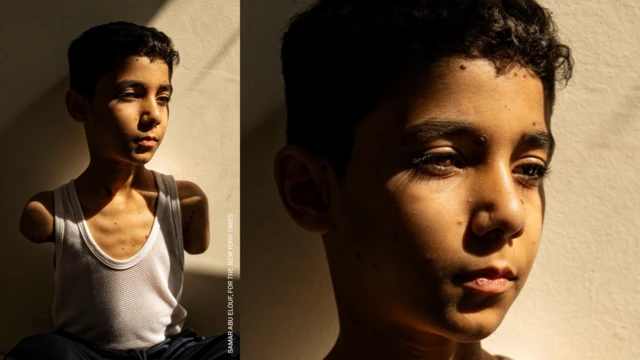 El impactante rostro de Mahmoud Ajjour, símbolo de los horrores de la guerra en Gaza.